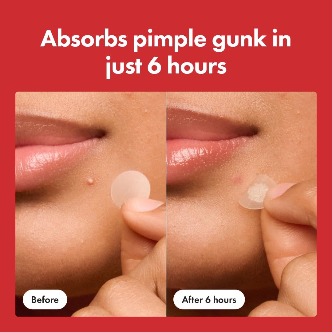 ClearSkin Hydro Spot Fix Patches